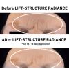 LIFT-STRUCTURE RADIANCE